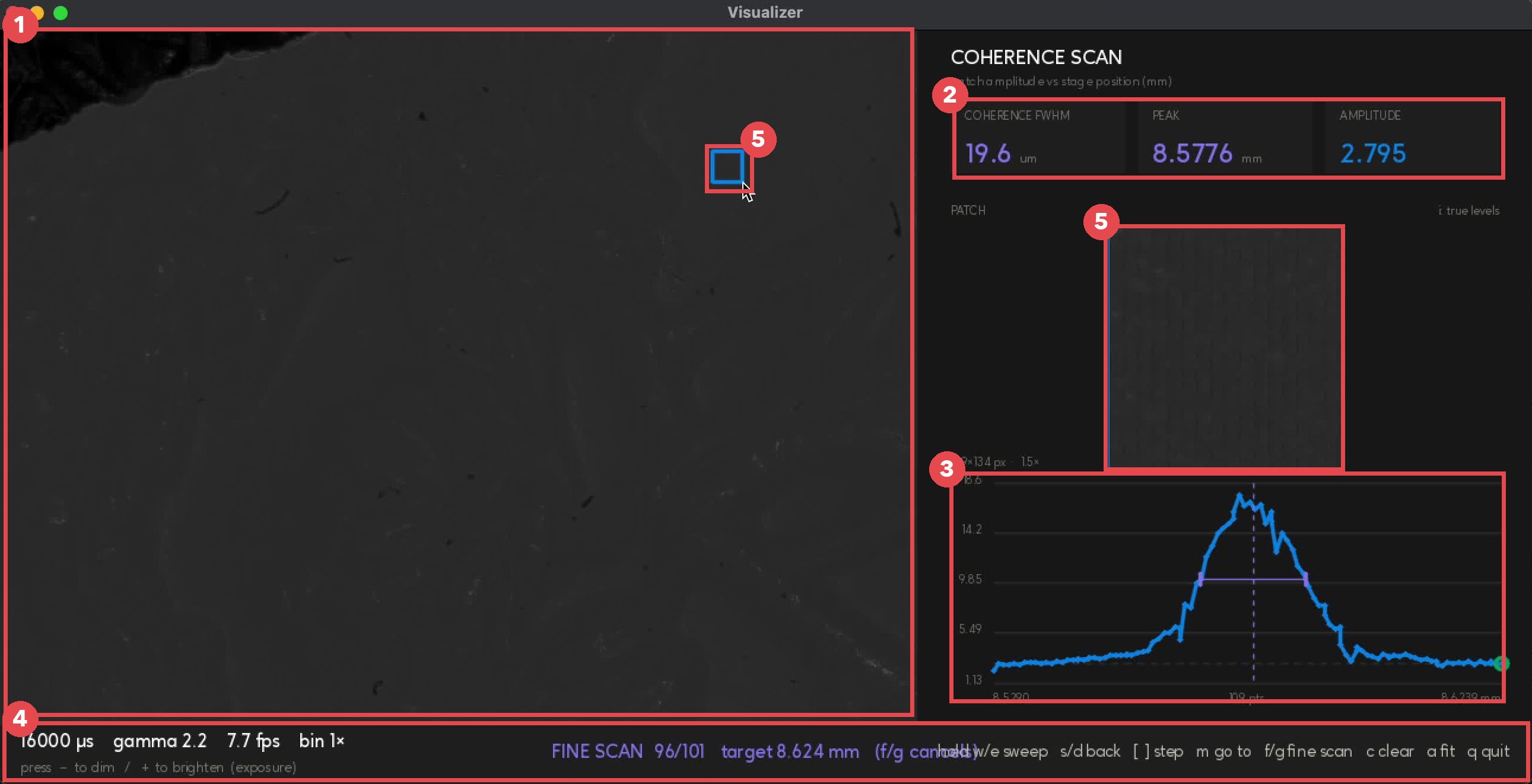 The visualizer with numbered red boxes: 1 live camera view, 2 stat tiles, 3 coherence plot, 4 status bar, 5 selected patch and its magnified inset